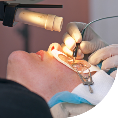 LASIK vs. PRK: Which is Right for You?